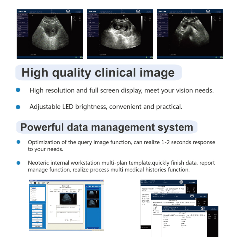 B ultrasound machines.jpg B ultrasound machines.jpg
